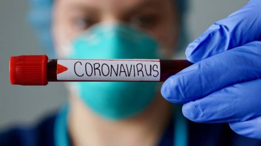 210 contagios nuevos de Coronavirus en Corrientes